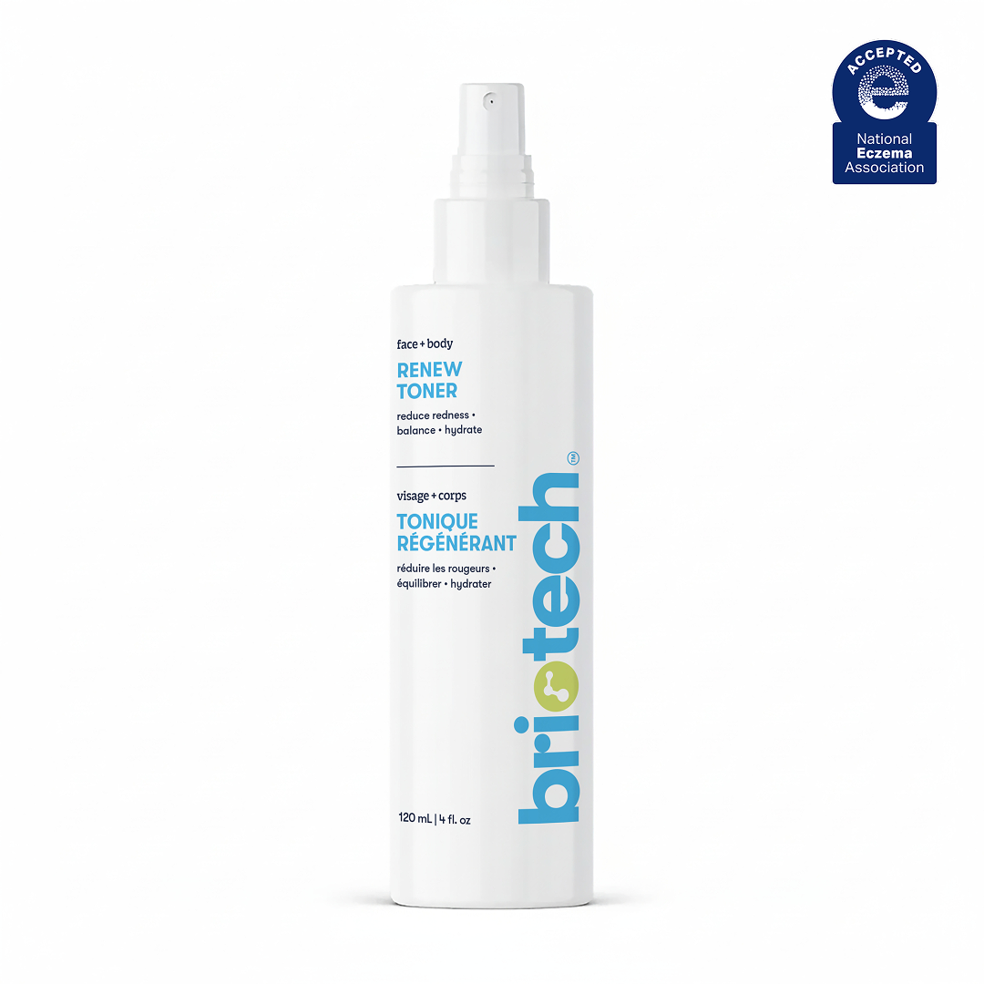 A white spray bottle labeled Renew Toner for face and body features blue and green text, a spray nozzle, the National Eczema Association Accepted seal, and helps calm redness as a soothing facial mist for healthy-looking skin.