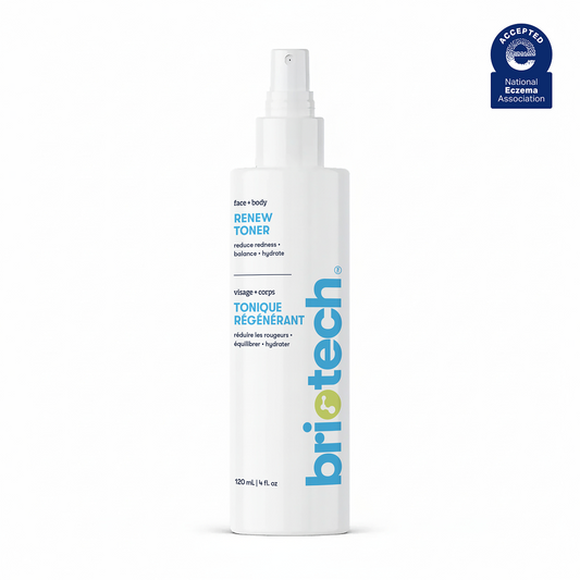 A white spray bottle labeled Renew Toner for face and body features blue and green text, a spray nozzle, the National Eczema Association Accepted seal, and helps calm redness as a soothing facial mist for healthy-looking skin.