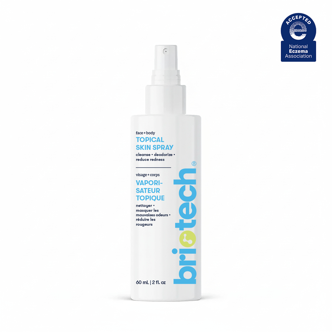 A white 60 mL spray bottle labeled Topical Skin Spray with blue and yellow text, recognized for soothing irritated skin, sits beside a National Eczema Association seal on a plain white background.